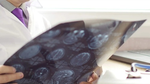 Medic care știe că sarcinamodifică creierul femeii