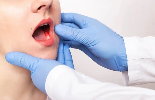 Medic care tratează parodontita