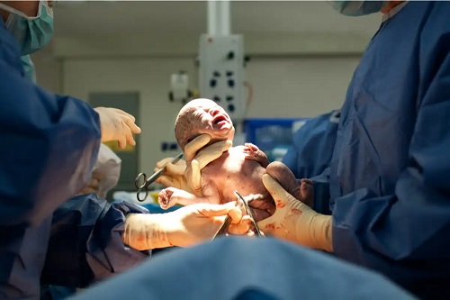 Nou născut prin cezariană
