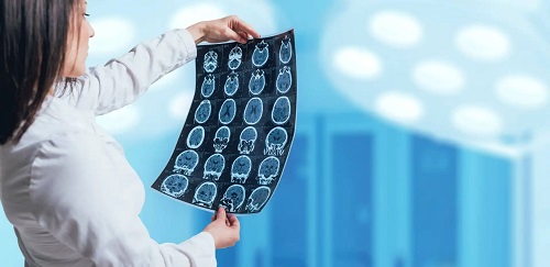 Specialist care analizează angiografia cerebrală