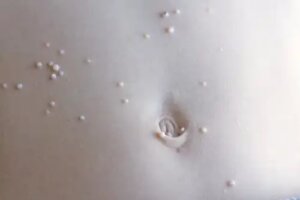 Ce tratament pentru molluscum contagiosum există?