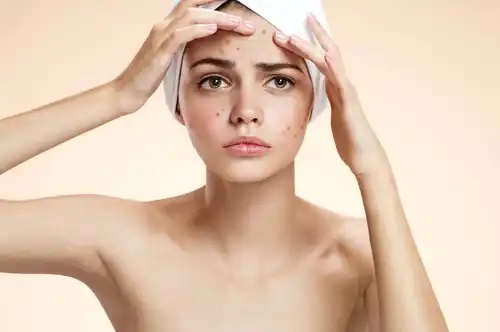 Fată care are nevoie de remedii naturiste pentru cele mai frecvente afecțiuni
