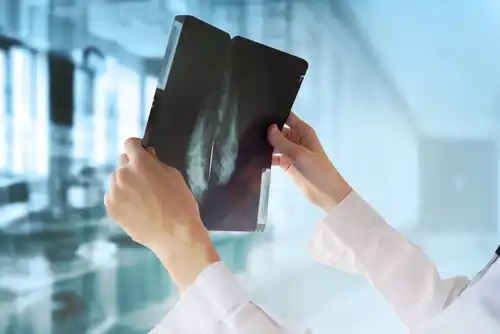 Medic care analizează o mamografie