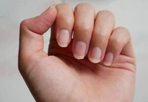 9 remedii pentru unghiile casante