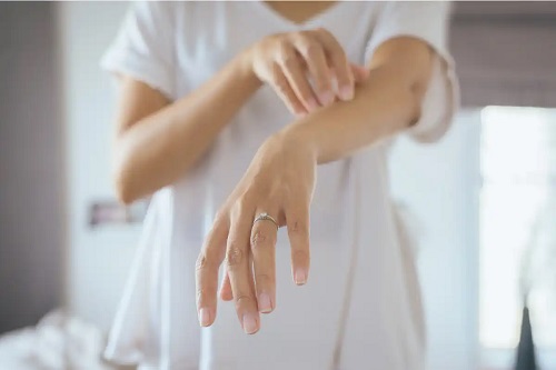 Femeie care are o eczemă