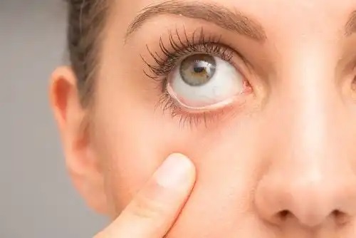 7 sfaturi pentru tratarea spasmului ocular