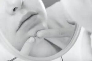 Cum se tratează coșurile de sub piele?