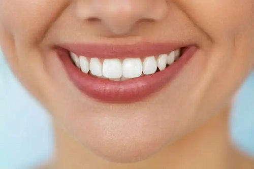 Albirea dinților în mod natural