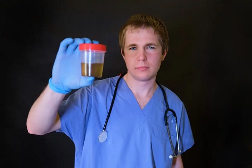 Medic care observă grăsimea în urină
