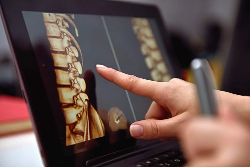 Medic care analizează măduva spinării