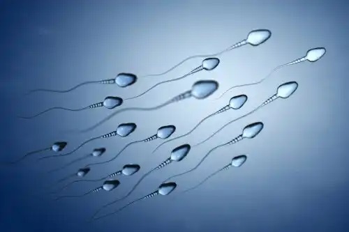 Sperma ca gelatina albă: este normal?