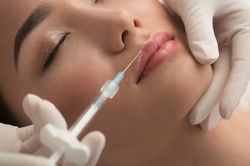 Acid hialuronic injectat în buze
