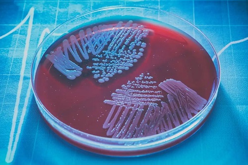 Cultură de bacterii