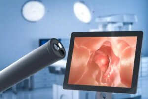 Chirurgia pentru boala de reflux gastroesofagian