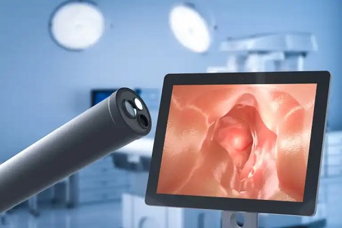 Chirurgia pentru boala de reflux gastroesofagian