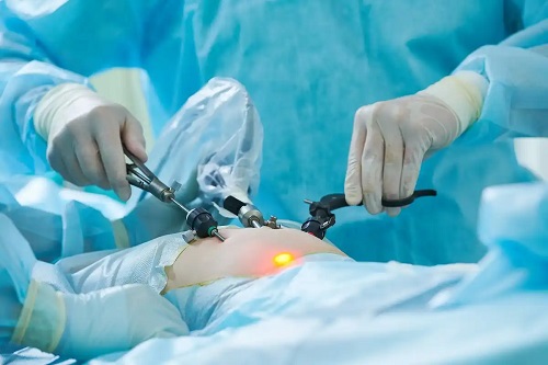 Gastropareza diabetică se tratează chirurgical
