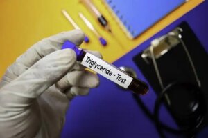 Nivelul trigliceridelor: ce ar trebui să știm?