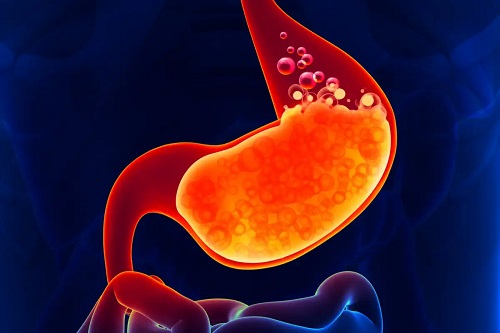 Refluxul gastric acid