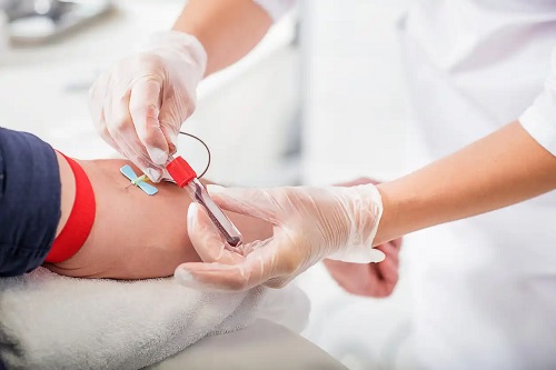 Cadru medical care recoltează sânge pentru analize
