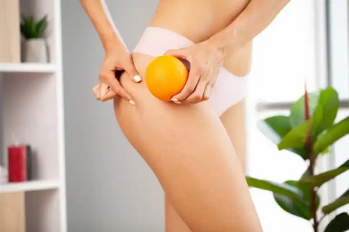 Tipuri de celulită și tratamentul lor: apoasă, fibroasă sau adipoasă