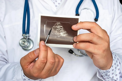 Medic care analizează nodulul tare sub piele