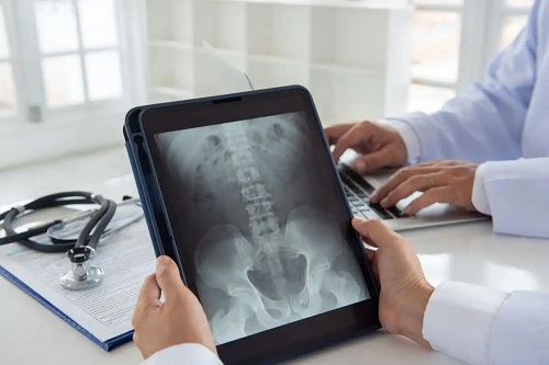 Radiografie a pelvisului