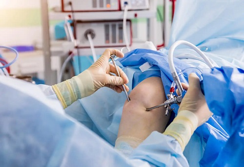 Medic care tratează efuziunea articulară