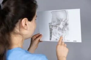 Ce este retrognația mandibulară și care este tratamentul acesteia?