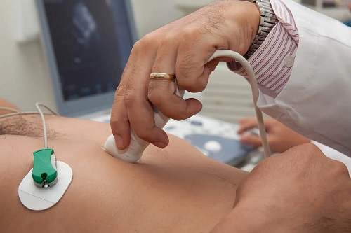 Specialist care diagnostichează complexul Carney