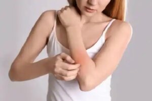 Cauzele, simptomele și tratamentul neurodermatitei