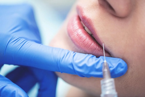 Stimulatorii naturali de colagen injectați în buze